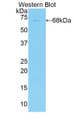 Western Blot; Sample: Recombinant protein.