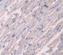 Collagen Type Xviii (Col18) Polyclonal Antibody, Cat#CAU24624