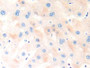 DAB staining on IHC-P; Samples: Human Liver Tissue; Primary Ab: 10µg/ml Rabbit Anti-Human COL18 Antibody Second Ab: 2µg/mL HRP-Linked Caprine Anti-Rabbit IgG Polyclonal Antibody