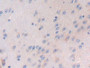 DAB staining on IHC-P; Samples: Mouse Cerebrum Tissue; Primary Ab: 30µg/ml Rabbit Anti-Mouse LTBP1 Antibody Second Ab: 2µg/mL HRP-Linked Caprine Anti-Rabbit IgG Polyclonal Antibody