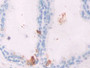 DAB staining on IHC-P; Samples: Human Prostate Tissue;  Primary Ab: 10µg/ml Rabbit Anti-Human GREM1