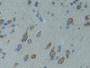 DAB staining on IHC-P; Samples: Human Cerebrum Tissue; Primary Ab: 10µg/ml Rabbit Anti-Human Smad9 Antibody Second Ab: 2µg/mL HRP-Linked Caprine Anti-Rabbit IgG Polyclonal Antibody