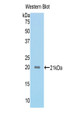 Western Blot; Sample: Recombinant protein.