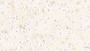 DAB staining on IHC-P; Samples: Human Cerebrum Tissue; Primary Ab: 20μg/ml Rabbit Anti-Human ACVR1B Antibody Second Ab: 2µg/mL HRP-Linked Caprine Anti-Rabbit IgG Polyclonal Antibody