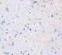 Used in DAB staining on fromalin fixed paraffin- embedded Kidney tissue