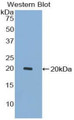 Western Blot; Sample: Recombinant protein.