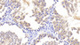 DAB staining on IHC-P; Samples: Mouse Testis Tissue; Primary Ab: 20μg/ml Rabbit Anti-Mouse GDF6 Antibody Second Ab: 2µg/mL HRP-Linked Caprine Anti-Rabbit IgG Polyclonal Antibody