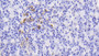 DAB staining on fromalin fixed paraffin-embedded Liver tissue)