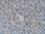 DAB staining on fromalin fixed paraffin- embedded tissue)