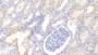 DAB staining on IHC-P; Samples: Human Kidney Tissue; Primary Ab: 30µg/ml Rabbit Anti-Human BMP3 Antibody Second Ab: 2µg/mL HRP-Linked Caprine Anti-Rabbit IgG Polyclonal Antibody