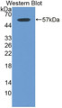 Western Blot; Sample: Recombinant protein.