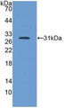 Western Blot; Sample: Recombinant ITGb5, Mouse.