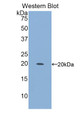 Western Blot; Sample: Recombinant ITGa10, Mouse.