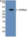 Western Blot; Sample: Recombinant MHCB, Human.