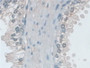 DAB staining on IHC-P; Samples: Human Prostate Tissue; Primary Ab: 20µg/ml Rabbit Anti-Human MHCB Antibody Second Ab: 2µg/mL HRP-Linked Caprine Anti-Rabbit IgG Polyclonal Antibody