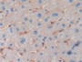 DAB staining on IHC-P; Samples: Human Liver Tissue; Primary Ab: 10µg/ml Rabbit Anti-Human MHCC Antibody Second Ab: 2µg/mL HRP-Linked Caprine Anti-Rabbit IgG Polyclonal Antibody