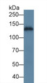 Western Blot; Sample: Human A431 cell lysate; Primary Ab: 5µg/ml Rabbit Anti-Human LAMC2 Antibody Second Ab: 0.2µg/mL HRP-Linked Caprine Anti-Rabbit IgG Polyclonal Antibody