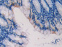 DAB staining on fromalin fixed paraffin- embedded heart tissue)