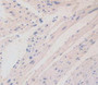 DAB staining on IHC-P; Samples: Mouse Heart Tissue