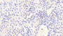 DAB staining on IHC-P; Samples: Human Kidney Tissue;  Primary Ab: 20μg/ml Rabbit Anti-Human ITaC Antibody Second Ab: 2µg/mL HRP-Linked Caprine Anti-Rabbit IgG Polyclonal Antibody 