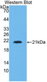 Western Blot; Sample: Recombinant protein.