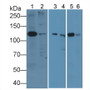 Western Blot; Sample: Lane1: Porcine Cerebrum lysate; Lane2: Porcine Heart lysate; Lane3: Bovine Cerebrum lysate; Lane4: Bovine Heart lysate; Lane5: Caprine Cerebrum lysate; Lane6: Caprine Heart lysate; Primary Ab: 5µg/mL Rabbit Anti-Human PDGFRa Ab; Second Ab: 0.2µg/mL HRP-Linked Caprine Anti-Rabbit IgG Polyclonal Antibody;