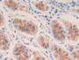 DAB staining on IHC-P; Samples: Human Stomach Tissue; Primary Ab: 30µg/ml Rabbit Anti-Human IL20 Antibody Second Ab: 2µg/mL HRP-Linked Caprine Anti-Rabbit IgG Polyclonal Antibody