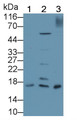 Western Blot; Sample: Lane1: PC3 cell lysate; Lane2: MCF7 cell lysate; Lane3: Jurkat cell lysate; Primary Ab: 2μg/ml Rabbit Anti-Human Surv Antibody; Second Ab: 0.2µg/mL HRP-Linked Caprine Anti-Rabbit IgG Polyclonal Antibody;