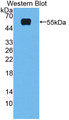 Western Blot Sample: Recombinant FXR, Rat