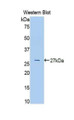 Western Blot; Sample: Recombinant protein.