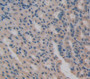 S100 Calcium Binding Protein A7 (S100A7) Polyclonal Antibody, Cat#CAU24806