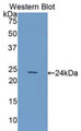 Western Blot; Sample: Recombinant protein.