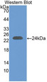 Western Blot; Sample: Recombinant protein.