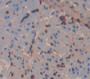 O-6-Methylguanine Dna Methyltransferase (Mgmt) Polyclonal Antibody, Cat#CAU24823