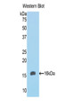 Western Blot; Sample: Recombinant protein.