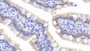 DAB staining on IHC-P; Samples: Rat Small intestine Tissue; Primary Ab: 20μg/ml Rabbit Anti-Rat KRT8 Antibody Second Ab: 2µg/mL HRP-Linked Caprine Anti-Rabbit IgG Polyclonal Antibody