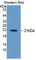 Western Blot; Sample: Recombinant protein.