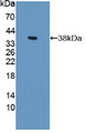 Western Blot; Sample: Recombinant S17aH, Rat.