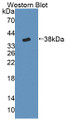 Western Blot; Sample: Recombinant protein.