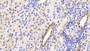 DAB staining on IHC-P; Samples: Human Kidney Tissue;  Primary Ab: 20μg/ml Rabbit Anti-Human S100A3 Antibody Second Ab: 2µg/mL HRP-Linked Caprine Anti-Rabbit IgG Polyclonal Antibody 