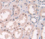 Used in DAB staining on fromalin fixed paraffin- embedded Kidney tissue