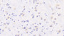 DAB staining on IHC-P; Samples: Mouse Cerebrum Tissue; Primary Ab: 10μg/ml Rabbit Anti-Mouse DPYD Antibody Second Ab: 2µg/mL HRP-Linked Caprine Anti-Rabbit IgG Polyclonal Antibody