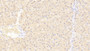 DAB staining on IHC-P. Samples: Human Tissue)