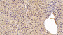 Complement Factor B (Cfb) Polyclonal Antibody, Cat#CAU24846