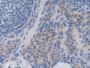 DAB staining on IHC-P; Samples: Mouse Ovary Tissue; Primary Ab: 10µg/ml Rabbit Anti-Mouse IL35 Antibody Second Ab: 2µg/mL HRP-Linked Caprine Anti-Rabbit IgG Polyclonal Antibody