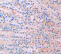 Interleukin 34 (Il34) Polyclonal Antibody, Cat#CAU24864