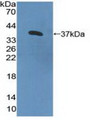 Western Blot; Sample: Recombinant IL8Rb, Human.