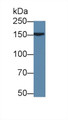 Western Blot; Sample: Rat Liver lysate; Primary Ab: 3µg/ml Rabbit Anti-Rat APOB Antibody Second Ab: 0.2µg/mL HRP-Linked Caprine Anti-Rabbit IgG Polyclonal Antibody