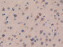 DAB staining on IHC-P; Samples: Mouse Brain Tissue; Primary Ab: 10µg/ml Rabbit Anti-Mouse CDH16 Antibody Second Ab: 2µg/mL HRP-Linked Caprine Anti-Rabbit IgG Polyclonal Antibody