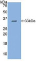 Western Blot; Sample: Recombinant ARRb1, Human.